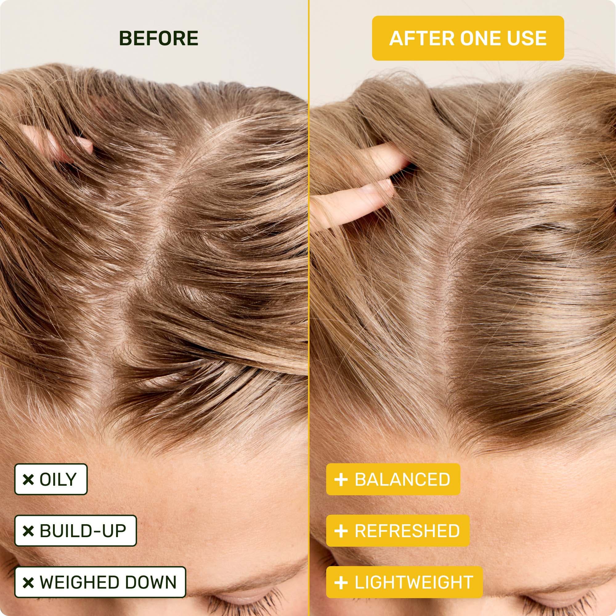 how to get rid of greasy hair