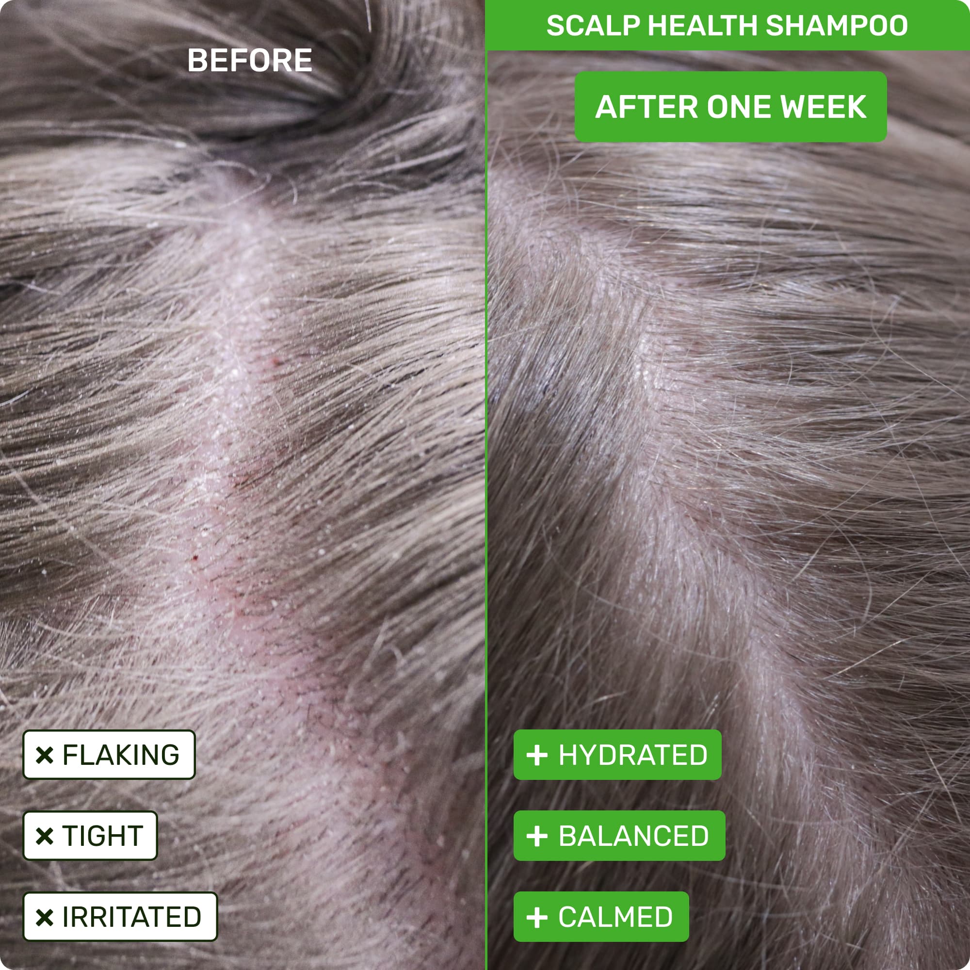 Scalp Health Shampoo: Before - flaking, right, irritated. After one week - hydrated, balanced, calmed.