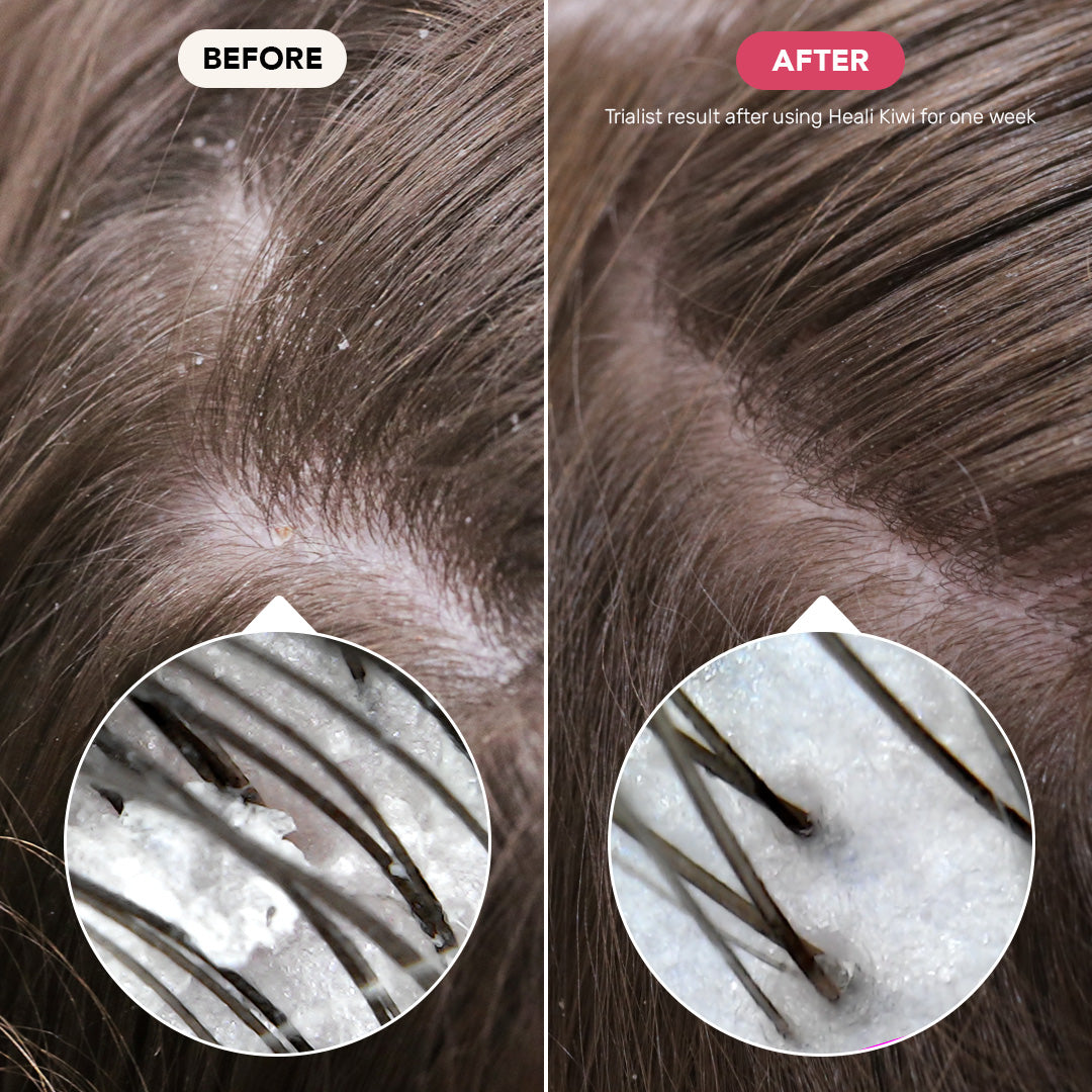 Calming Shampoo Bar for Dry Scalps: Heali Kiwi™