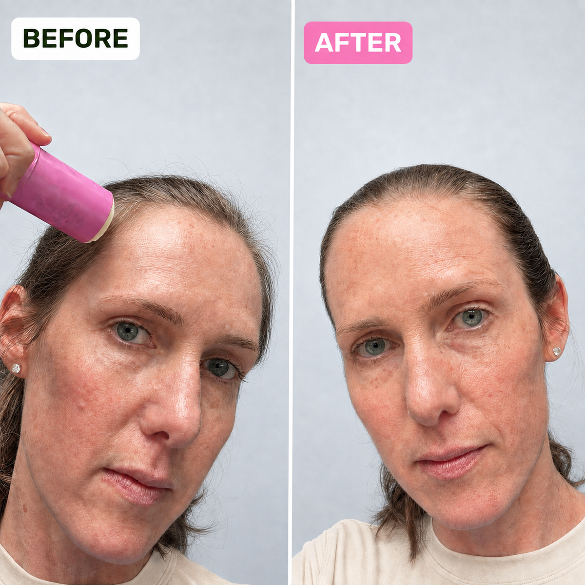 BEFORE and AFTER